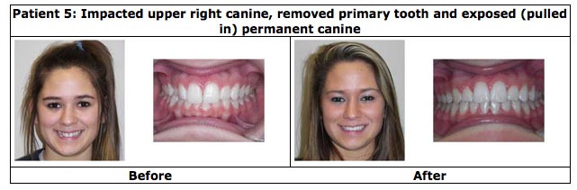 Patient before and after